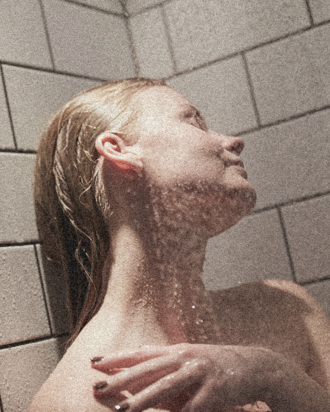 Battling Hormonal Acne: Lifestyle, Diet, and Natural Hacks for Beautiful Skin